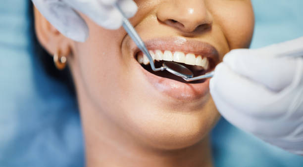 Best Emergency Dental Care for Abscessed Tooth in Holt, AL